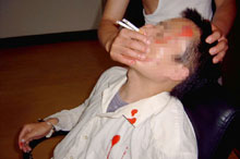 中共酷刑演示：将烟点着插入法轮功学员的鼻孔，把嘴捂住，熏呛、窒息，极为痛苦